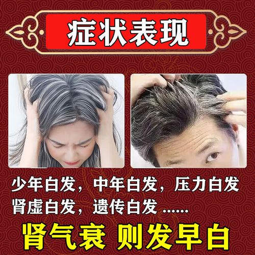 女生掉头发吃什么药