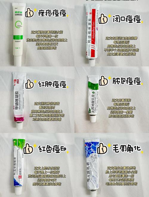 什么药膏祛痘效果好