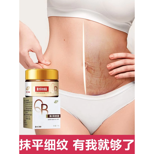 肥胖纹用什么药膏