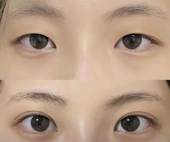 内双是什么样的