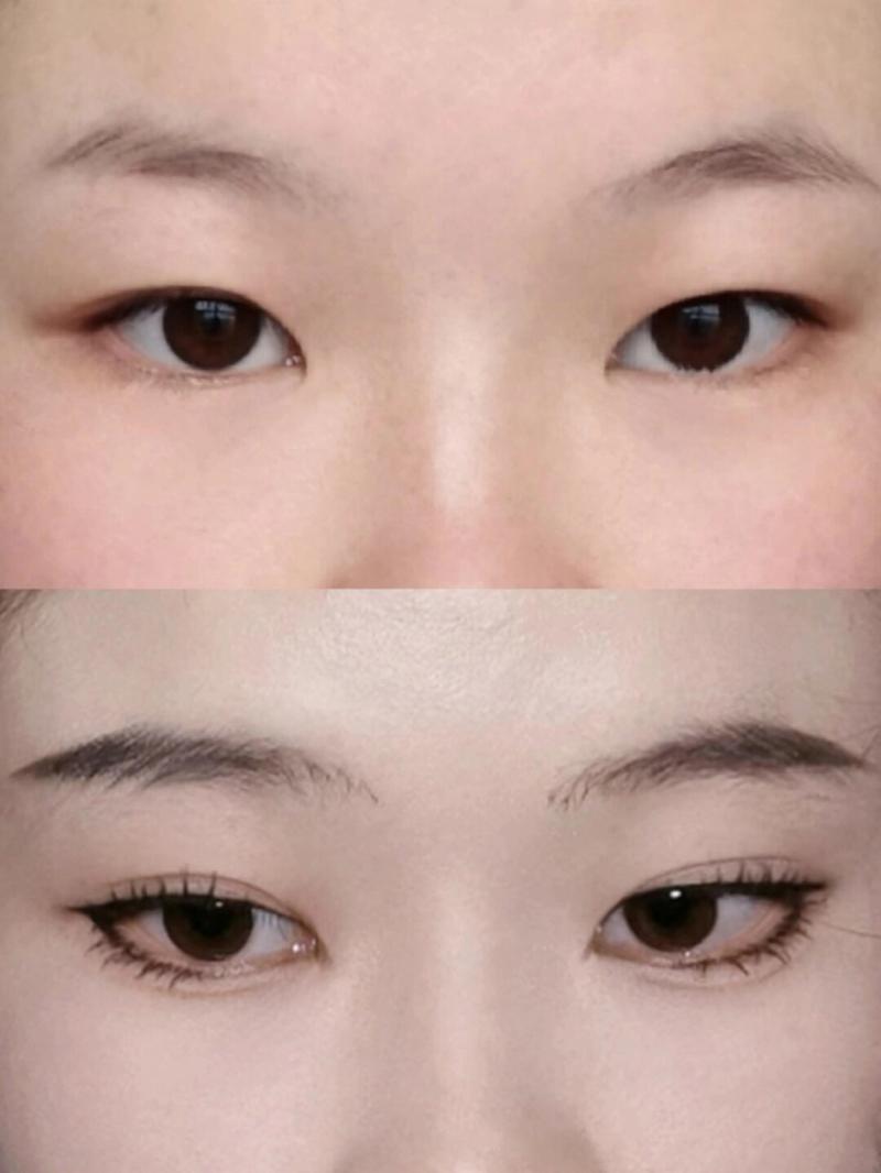 内双是什么样的