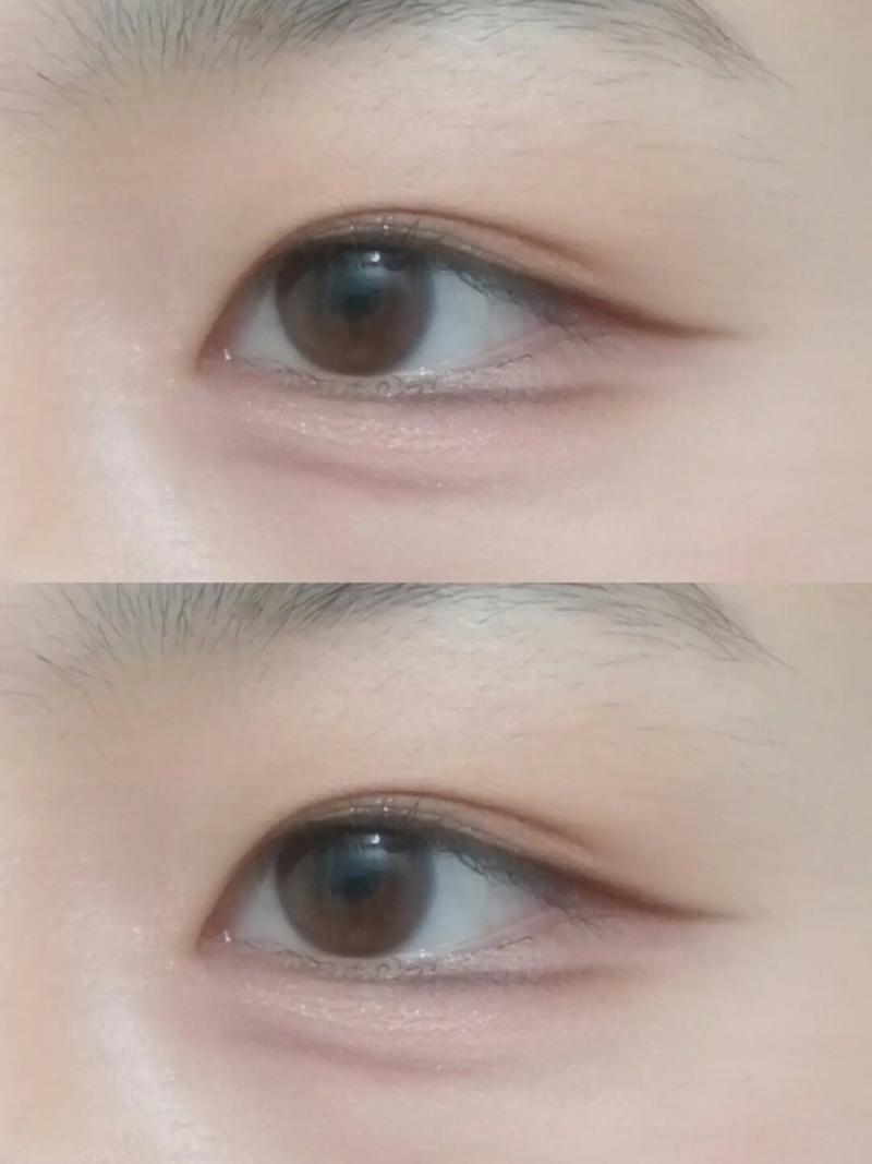 内双是什么样的