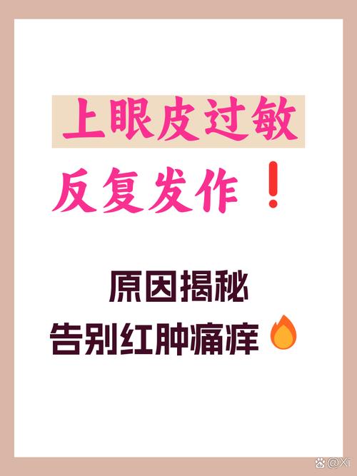 反复过敏是什么原因