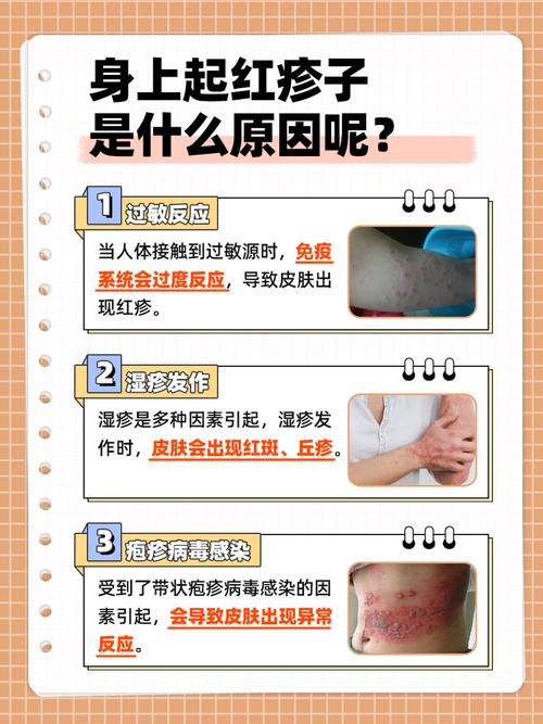 反复过敏是什么原因