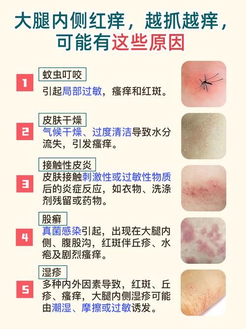 反复过敏是什么原因