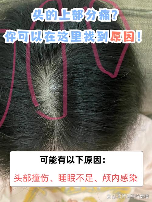 头皮疼是什么情况