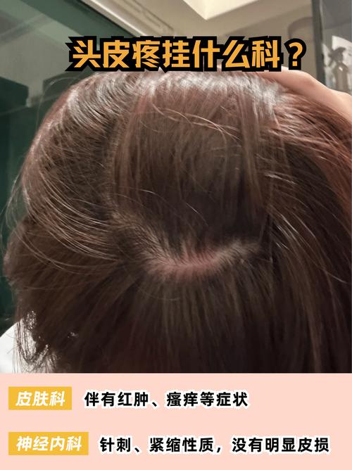 头皮疼是什么情况