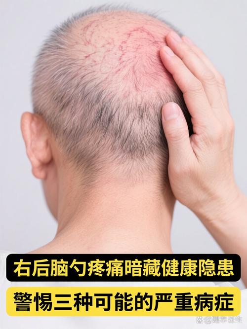 头皮疼是什么情况