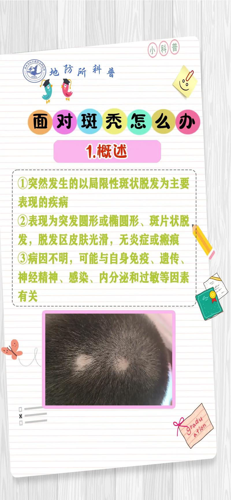 斑秃要注意什么