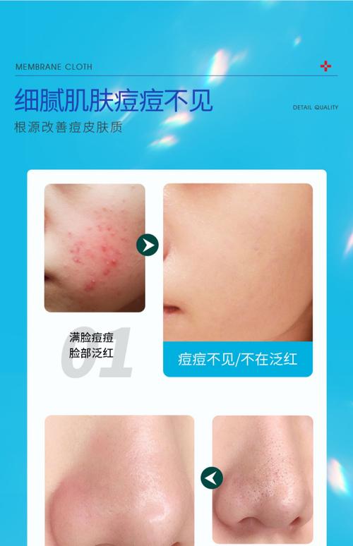 祛痘印用什么效果好