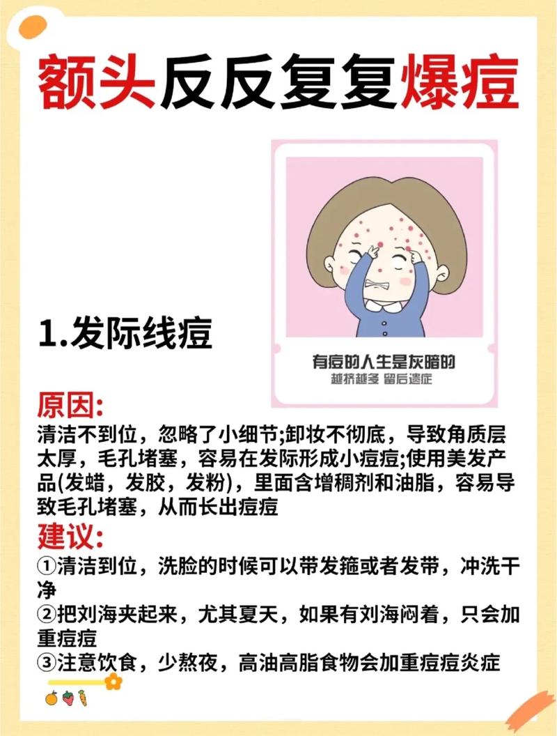 额头上为什么长痘痘