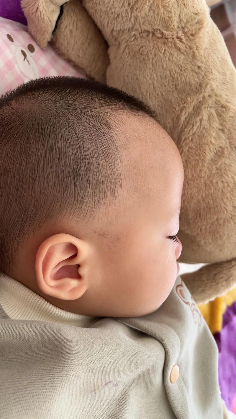 婴儿为什么掉头发