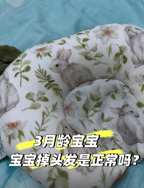 婴儿为什么掉头发