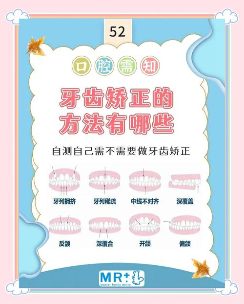 戴牙套有什么好处