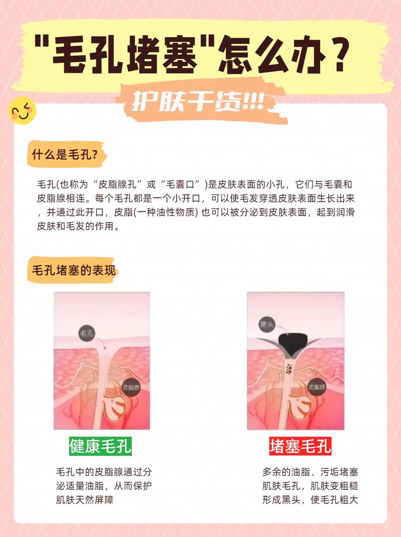 为什么会毛囊堵塞