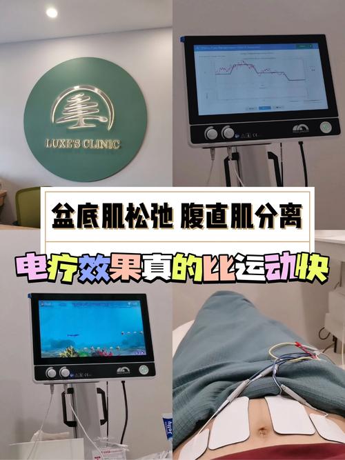 什么是电疗减肥