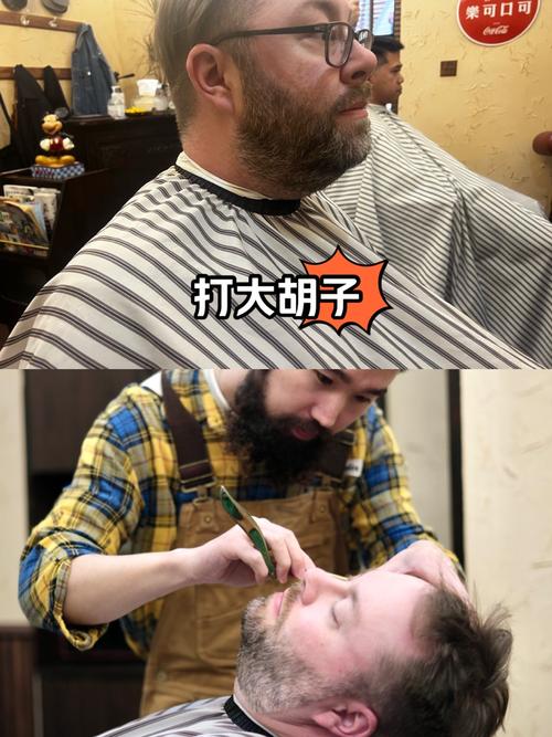 胡子多是什么原因