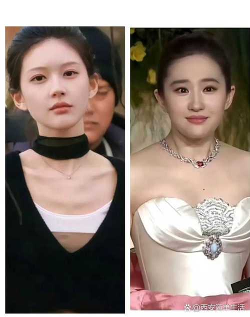 减肥瘦脖子叫什么名字