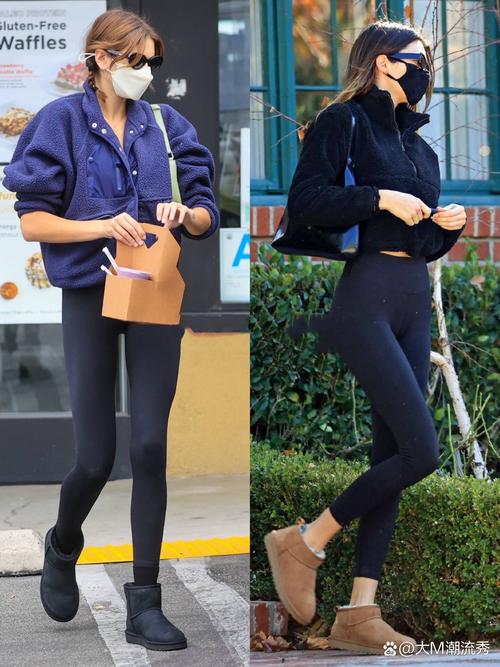 ugg怎么搭配衣服