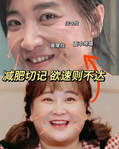 减肥成功了为什么脸没瘦多少