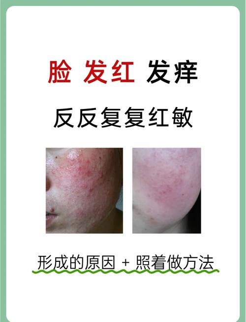 脸部泛红是什么原因