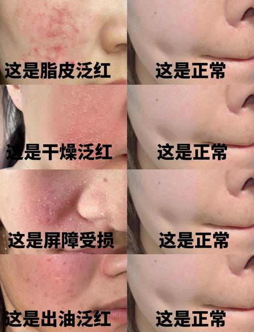 脸部泛红是什么原因