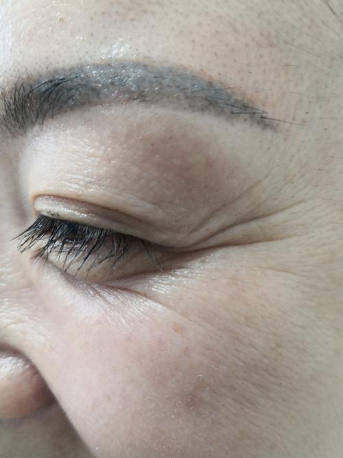 眼角的皱纹叫什么