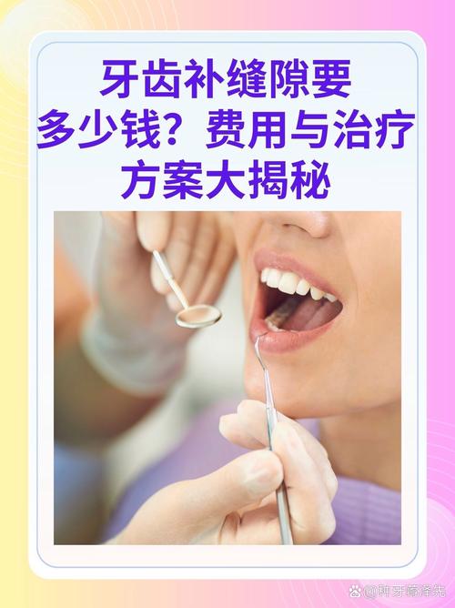 为什么补牙这么贵