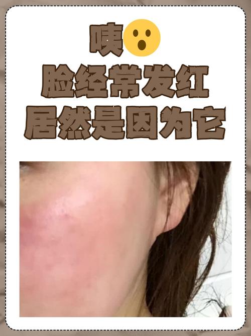 为什么脸老是过敏