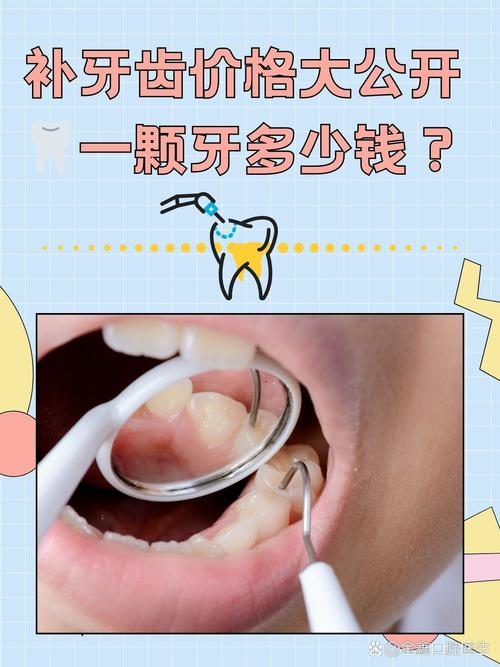 补牙为什么这么贵