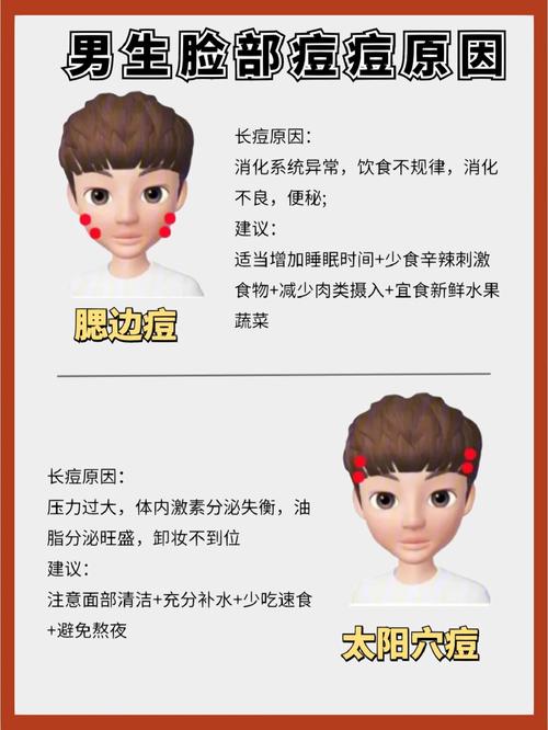 脸上为什么老是长痘