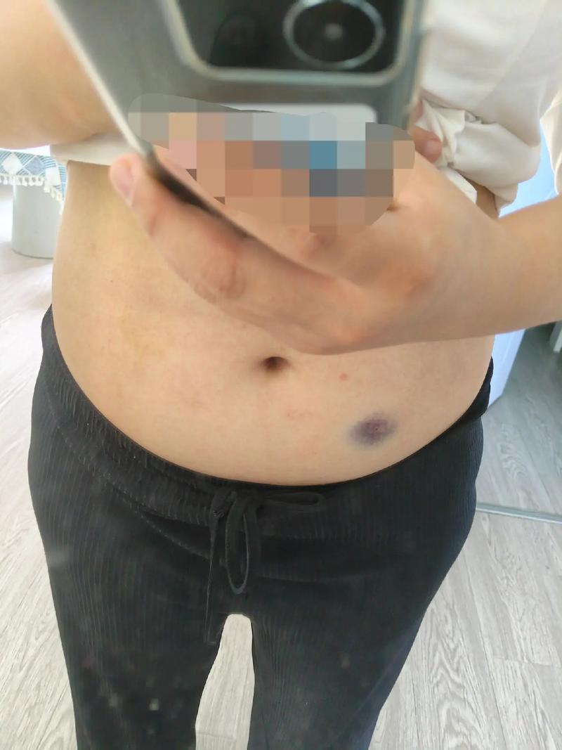 肚子肿大是什么病