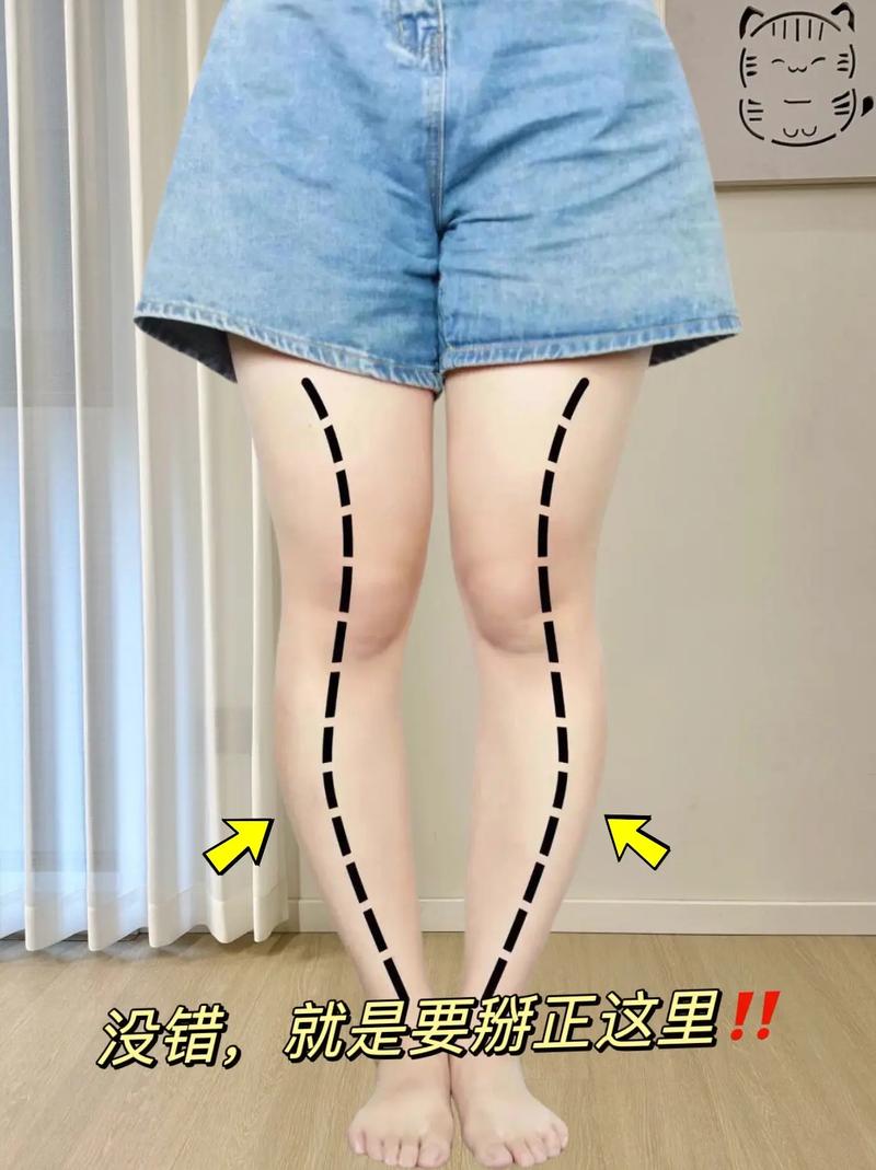 0型腿怎么穿衣搭配