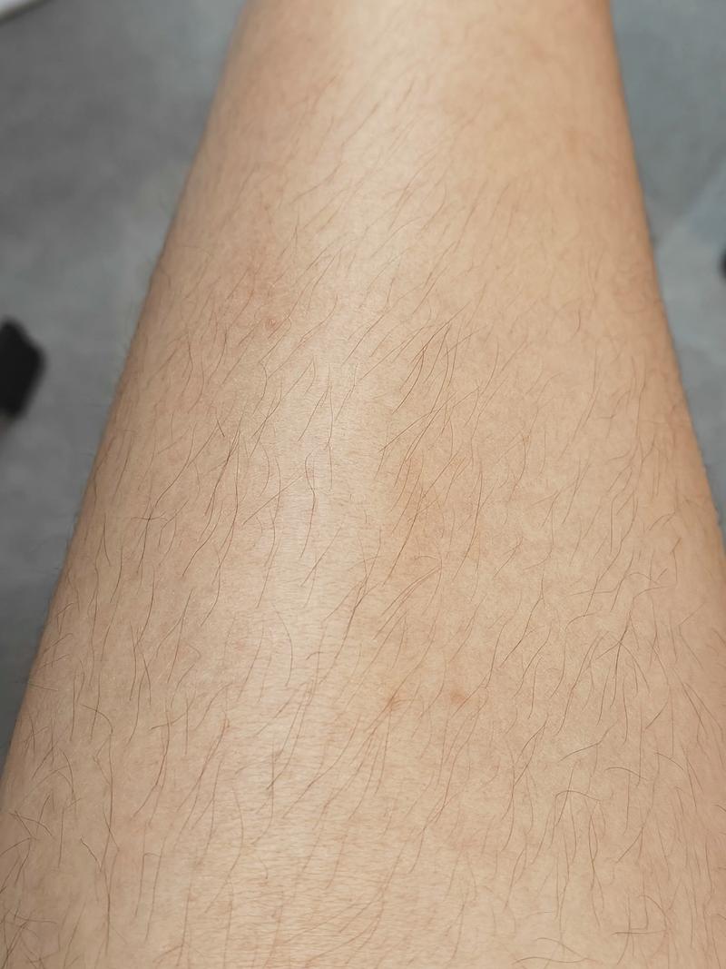 腿毛有什么作用