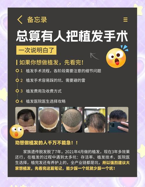 植发有什么危害