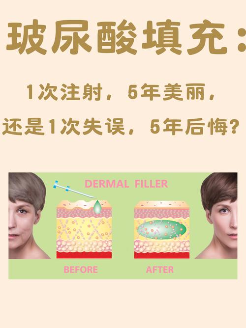 玻尿酸什么味道