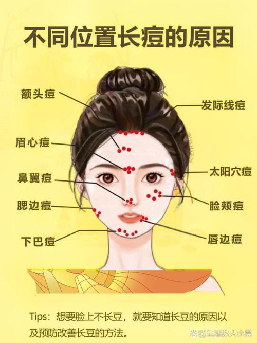 右脸颊长痘什么原因