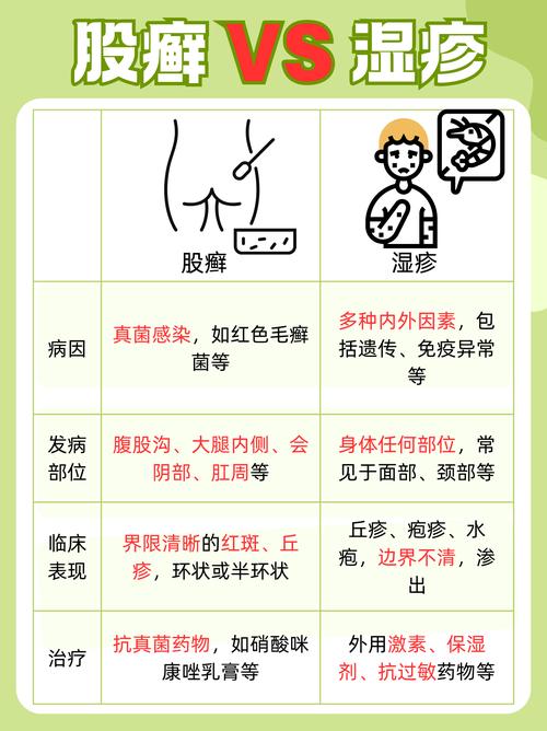 为什么会有股癣