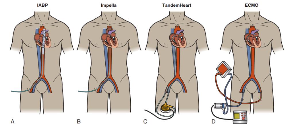 什么器官可以移植
