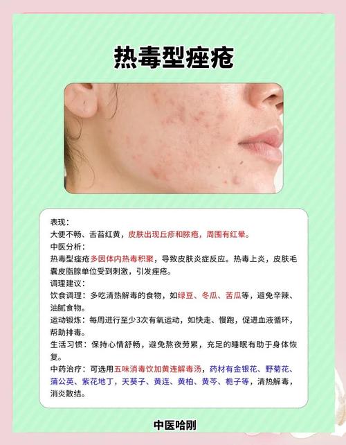 为什么会得痤疮