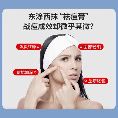 长青春痘吃什么药