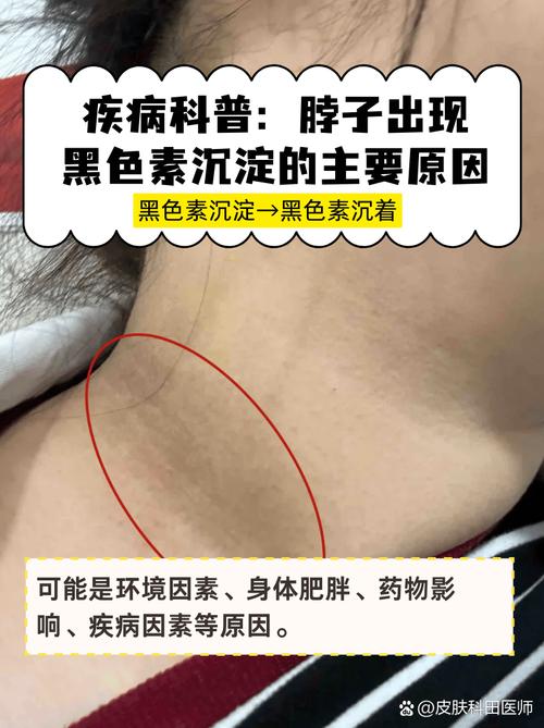 肤色黑是什么原因