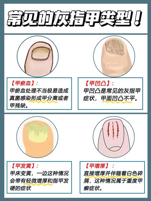 做指甲有什么危害