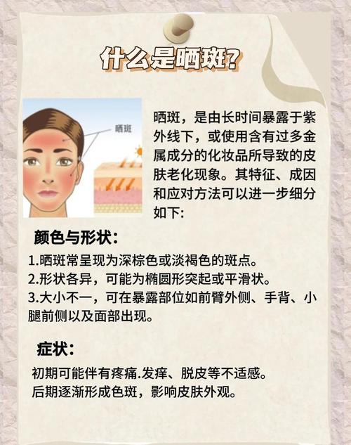 什么方法祛斑最有效