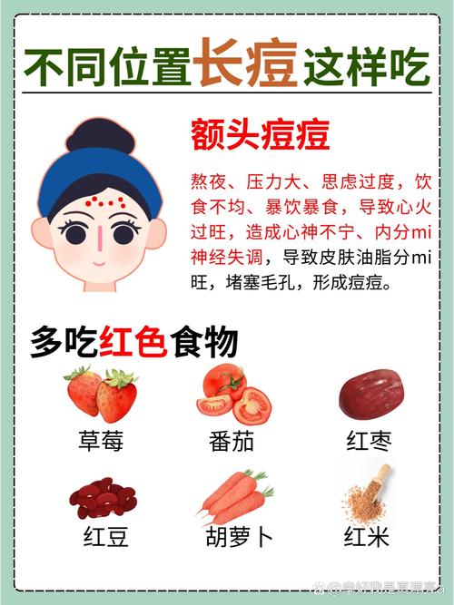 额头上长痘什么原因