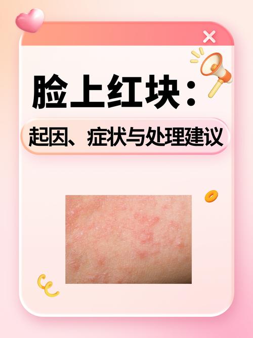 脸色红是什么原因