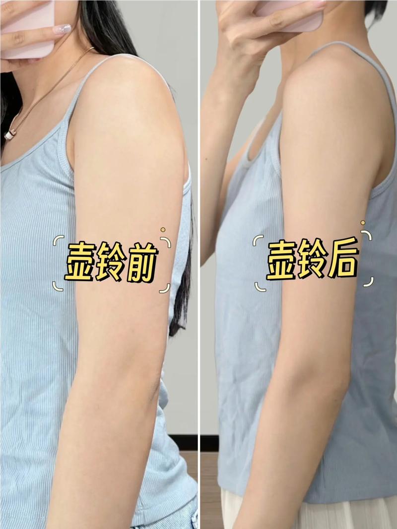 胳膊为什么会变粗