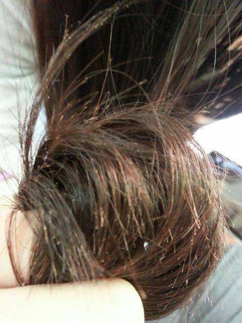 为什么头发会开叉