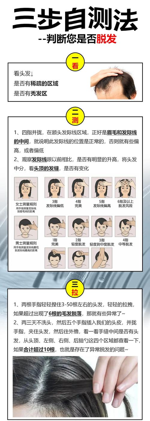 脱发要做什么检查