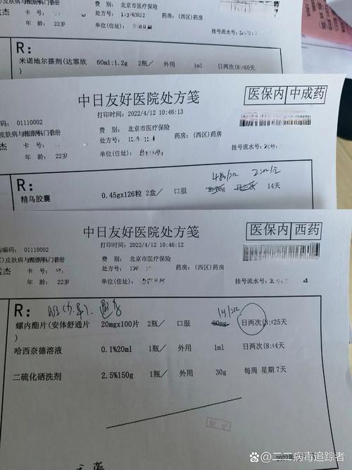 脱发要做什么检查